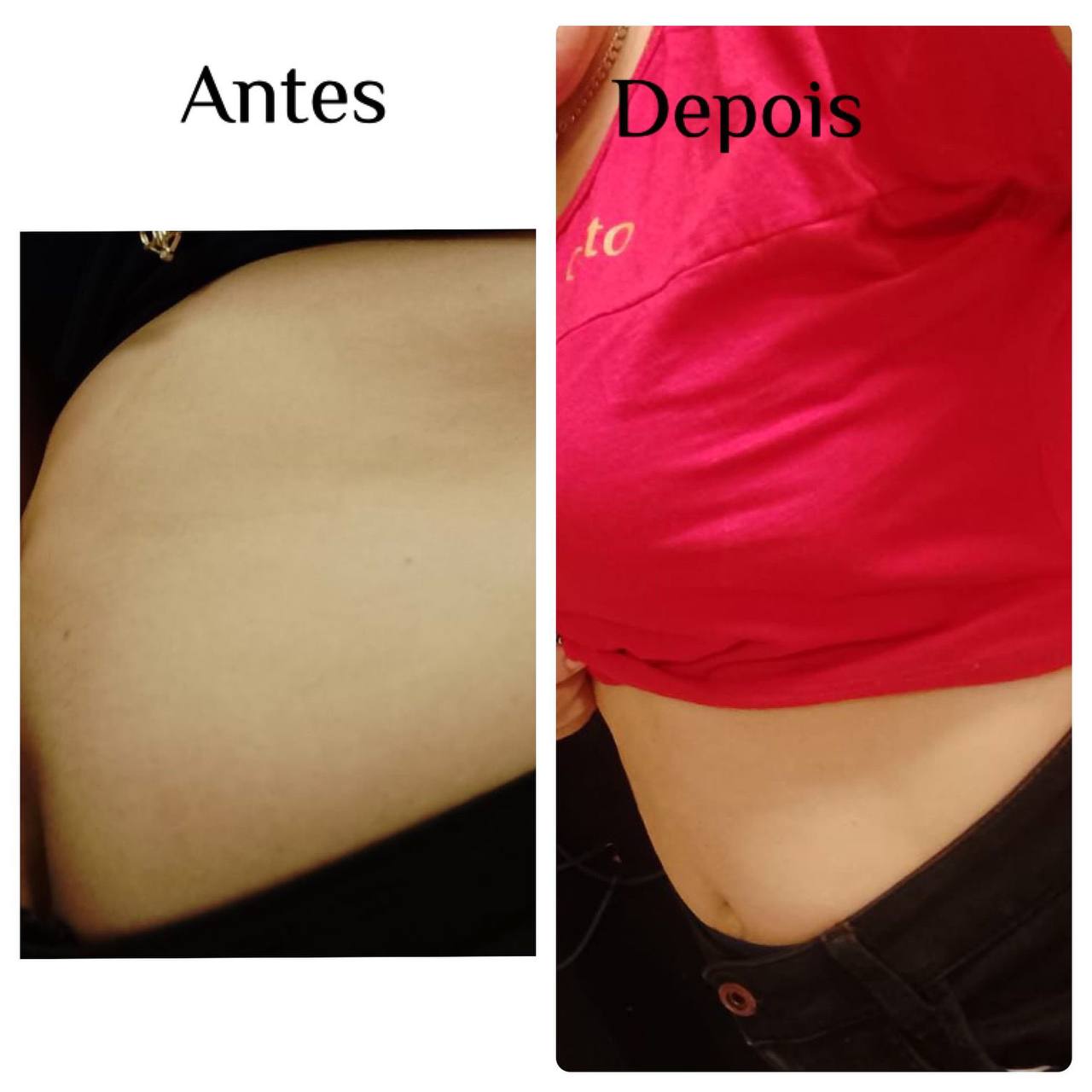 Diurie Fit Black antes e depois — redução de inchaço na barriga