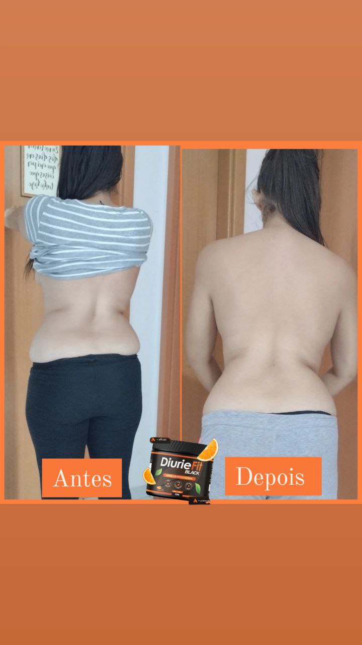Diurie Fit Black antes e depois — redução de inchaço nas costas