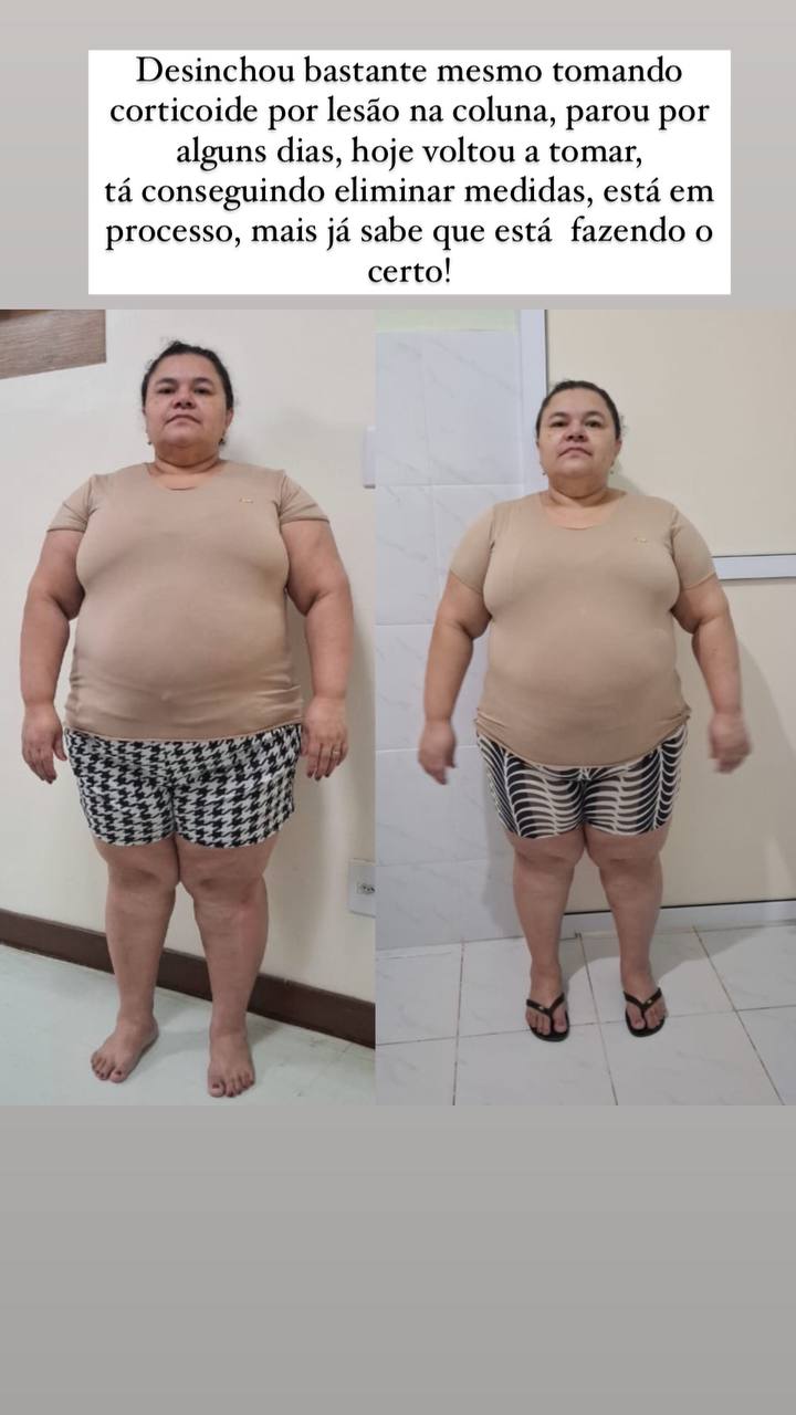 Diurie Fit Black antes e depois — cliente desinchou mesmo tomando corticoide