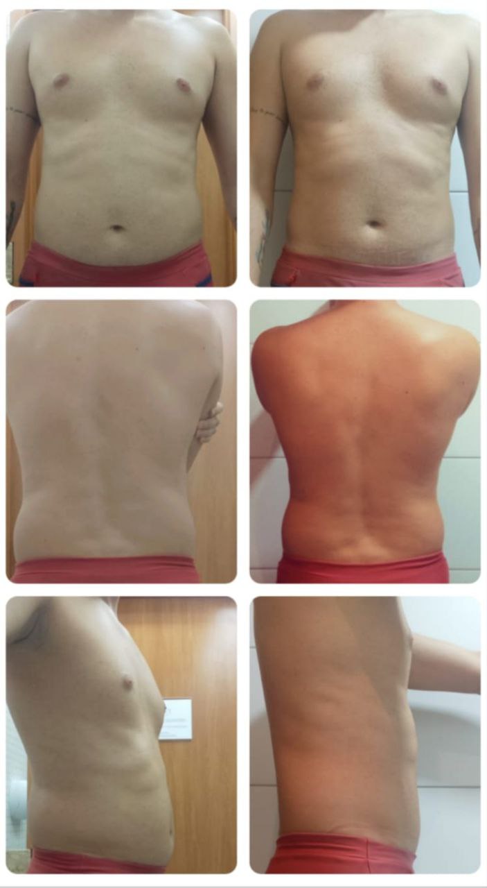 Diurie Fit Black antes e depois — homem corpo inteiro frente e costas